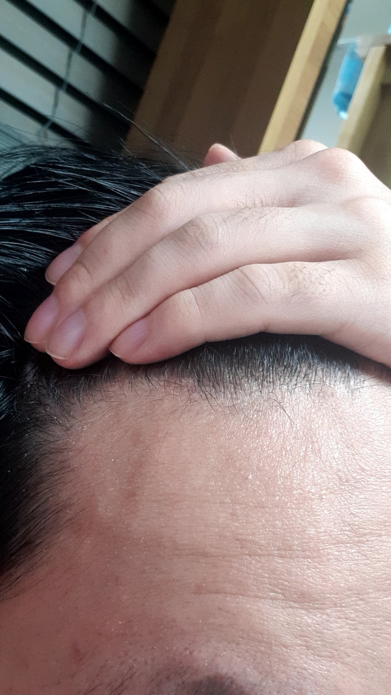 .저 m자탈모인지 확인부탁드립니다
