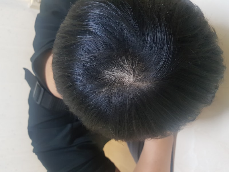 머리 사진3.jpg