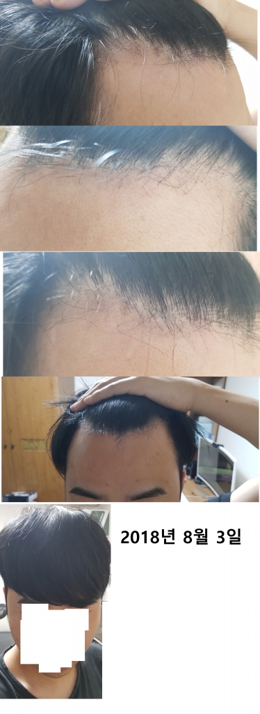 ㅇㅇㅇㅇㅇㅇ.jpg