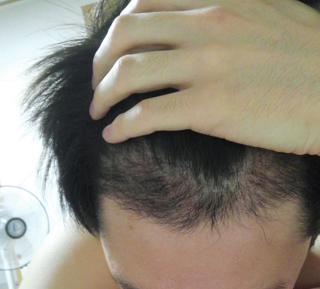 20151021_030002.jpg
