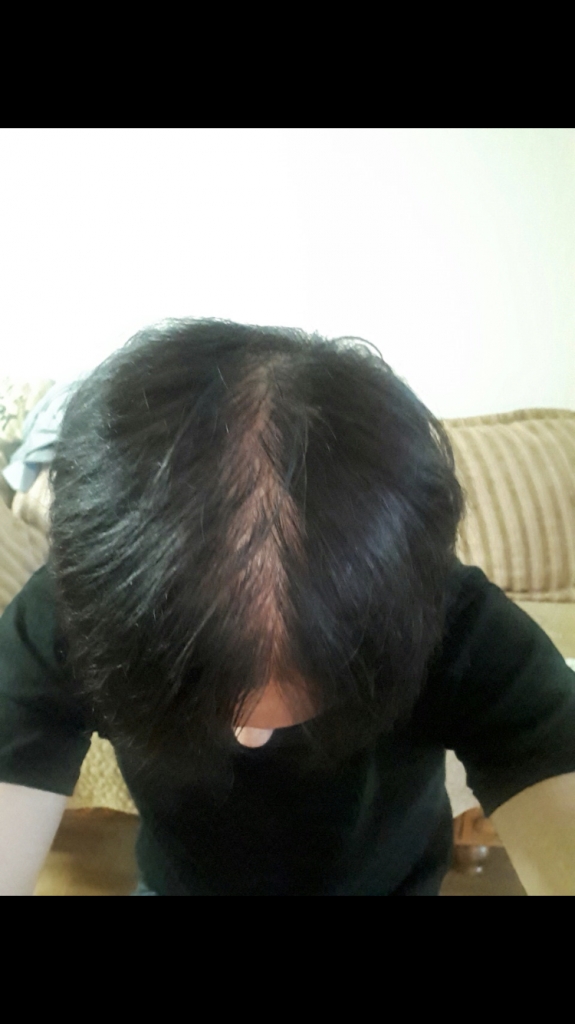 2AA7025D-43C5-4F44-B1E1-ABD507B8F4D2.png