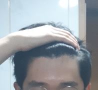 이마 2.JPG