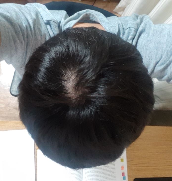 정수리.JPG