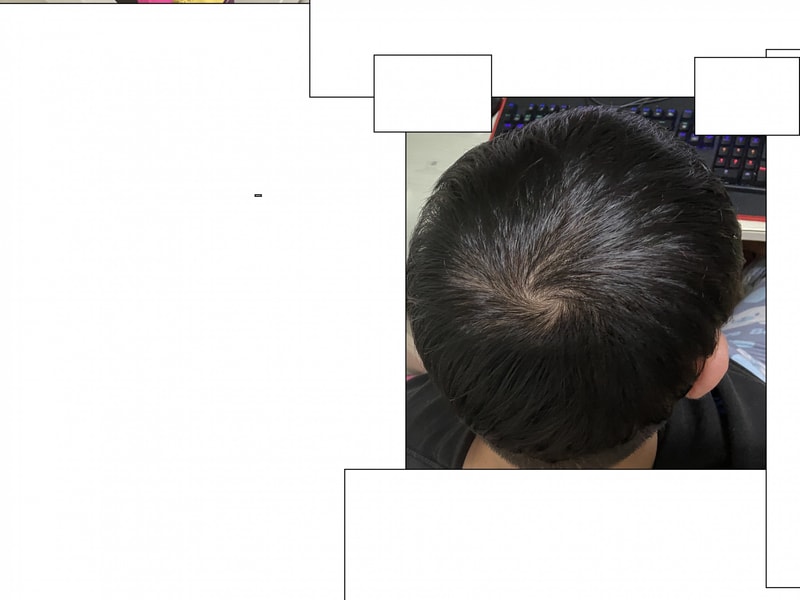 정수리.JPG