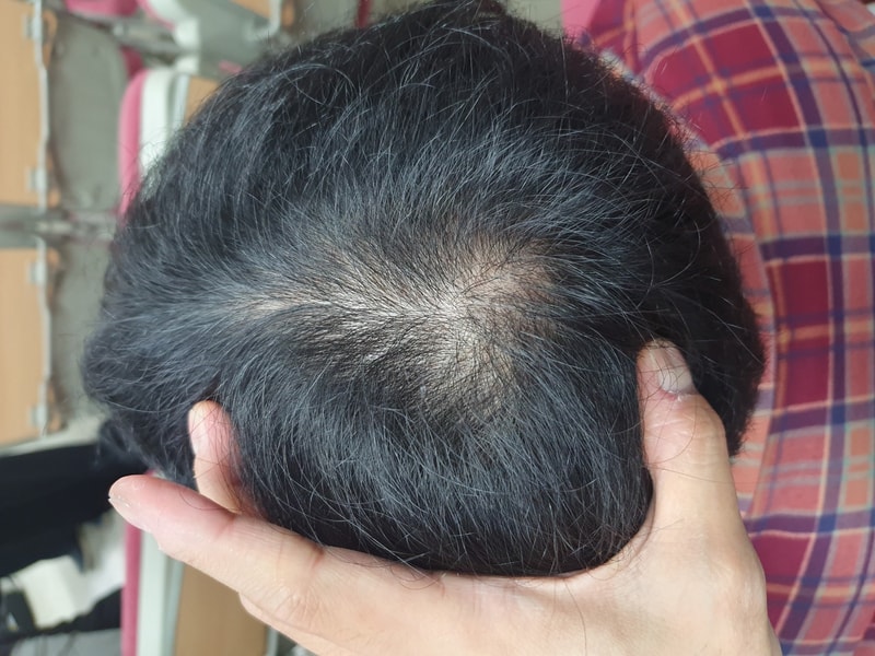 머리평가좀 해주시겠어요?