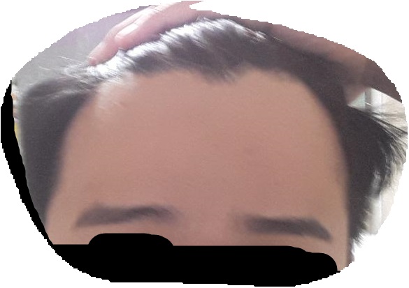 이마.jpg