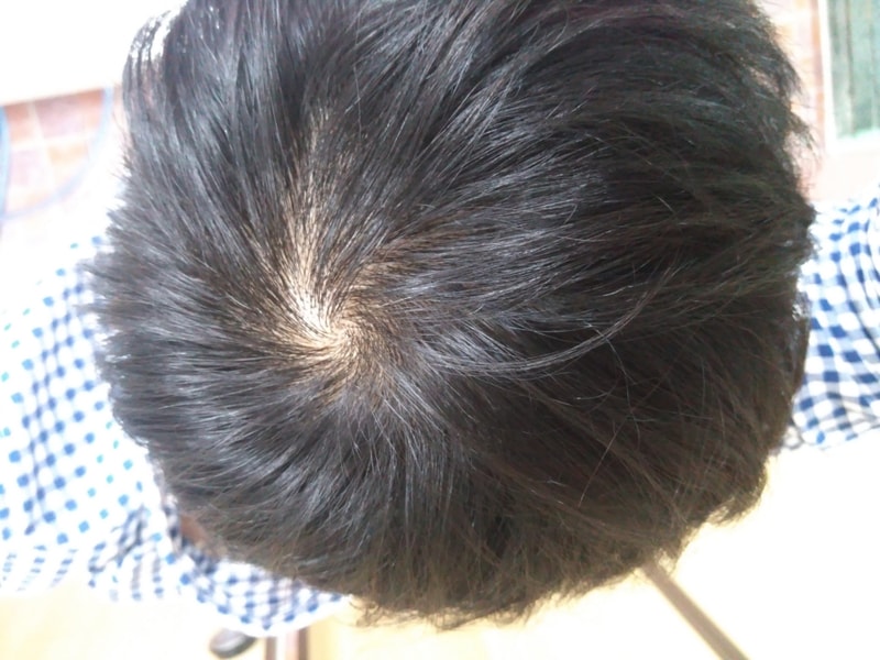 사본 -정수리.jpg