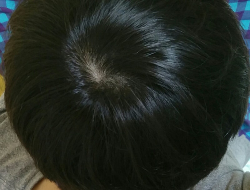 CROP_20151121_162030.JPG