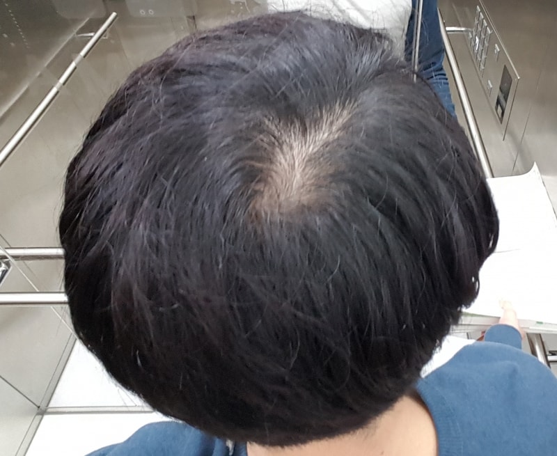 20170824_135049.jpg