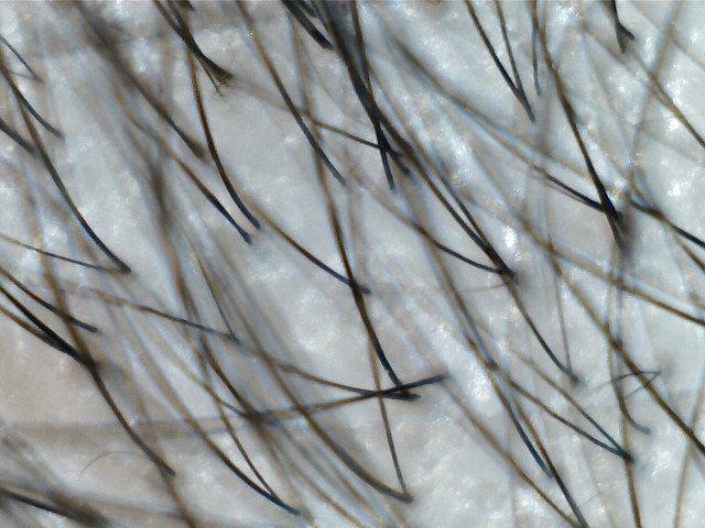 정수리1.jpg