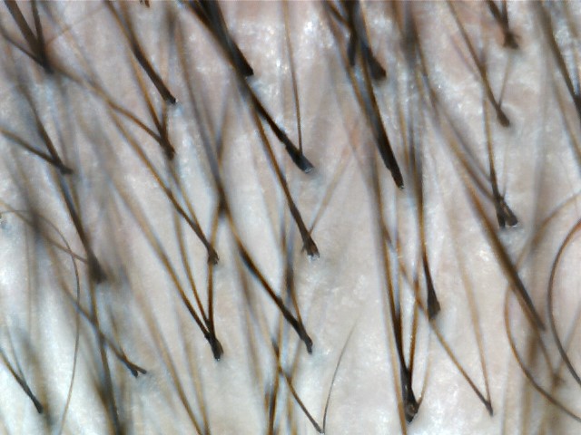 정수리2.jpg