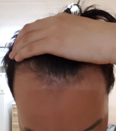 현재