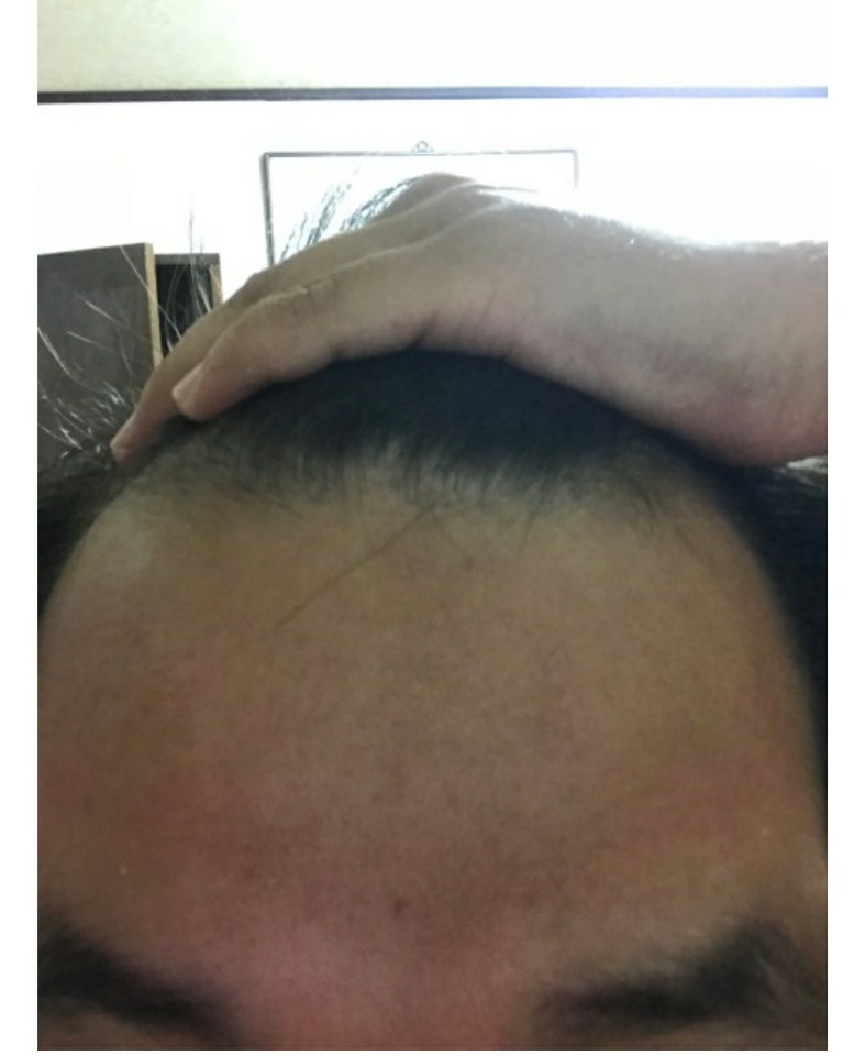 2018.07.23 정면.jpg
