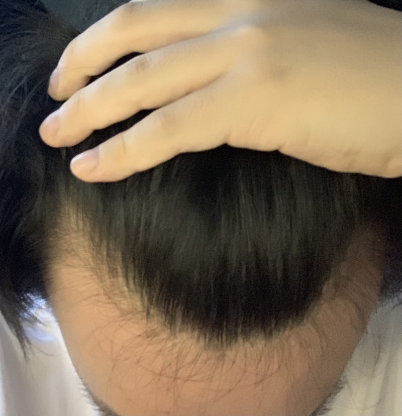 3C95EAE3-0A5B-4ADF-AD94-C0E567FA36E5.jpeg