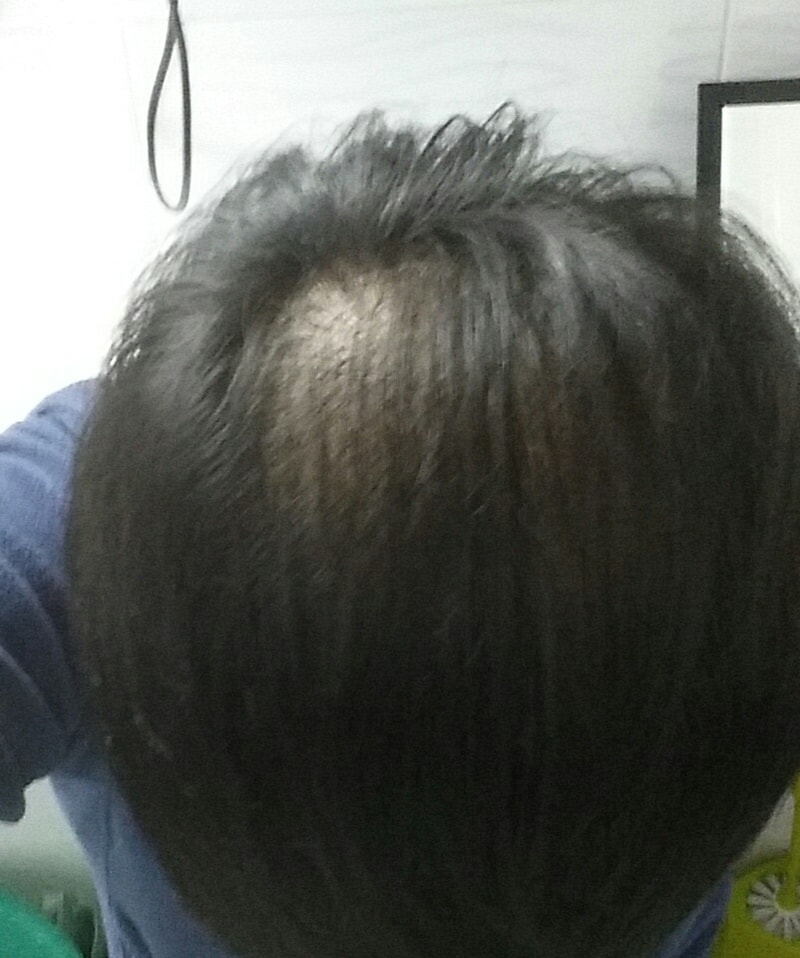 20161121_231541.jpg