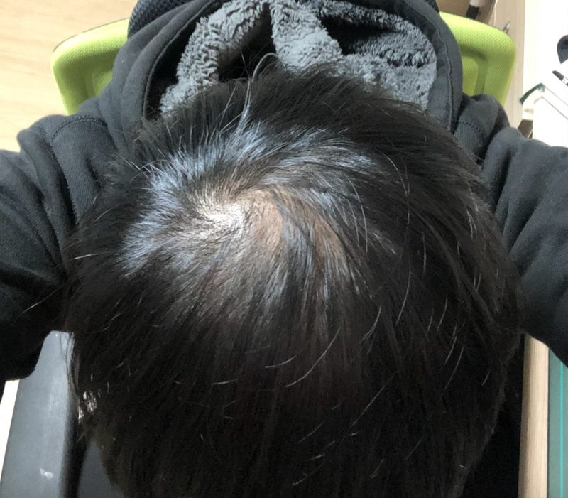 스크린샷 2021-04-17 오후 11.03.25.png