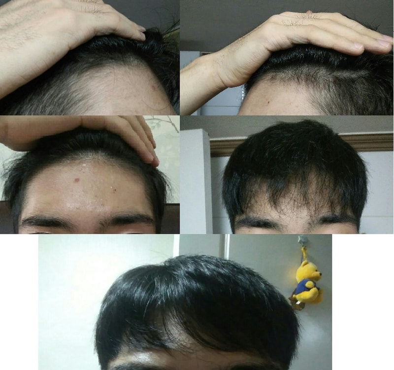 머리.jpg