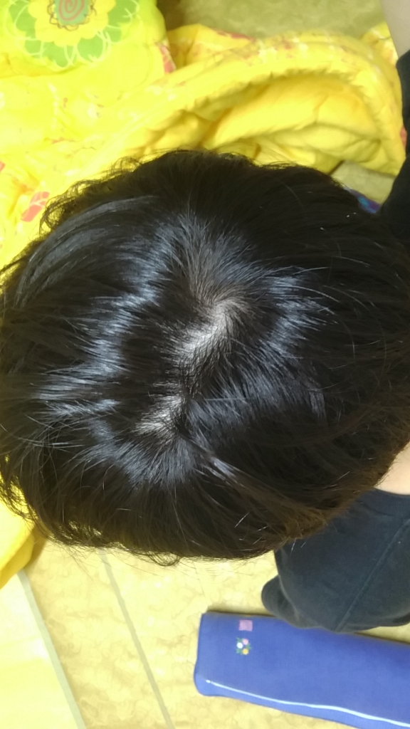 20151105_201636.jpg