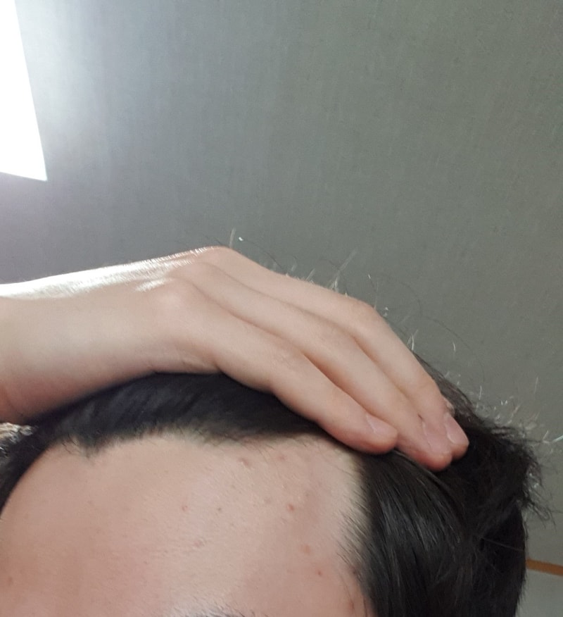 이마 사진.jpg