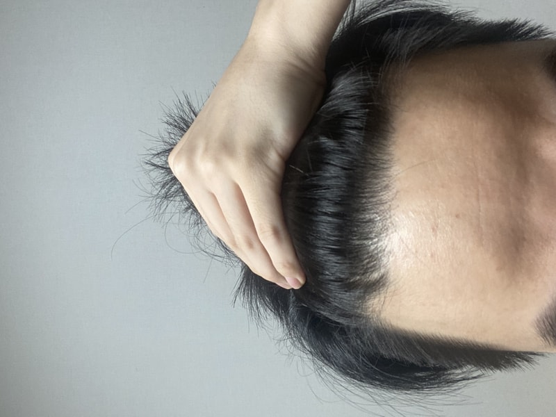 형님들 m자인지 좀 봐주세요..
