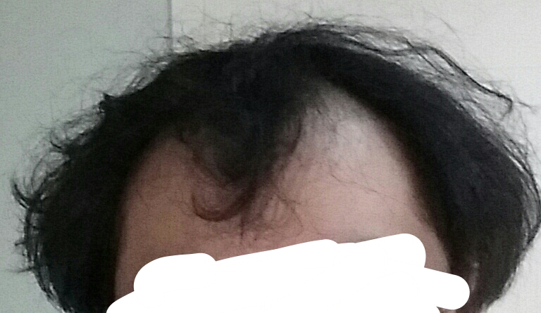 2017-03-08_19.56.25.jpg
