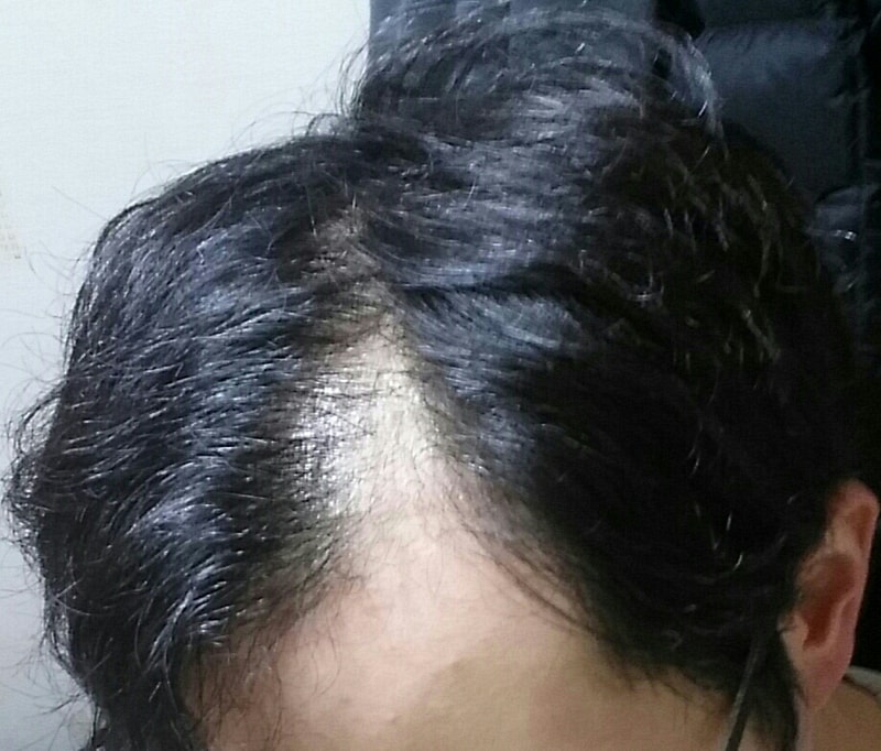 20151219_001747-1-1-1.jpg