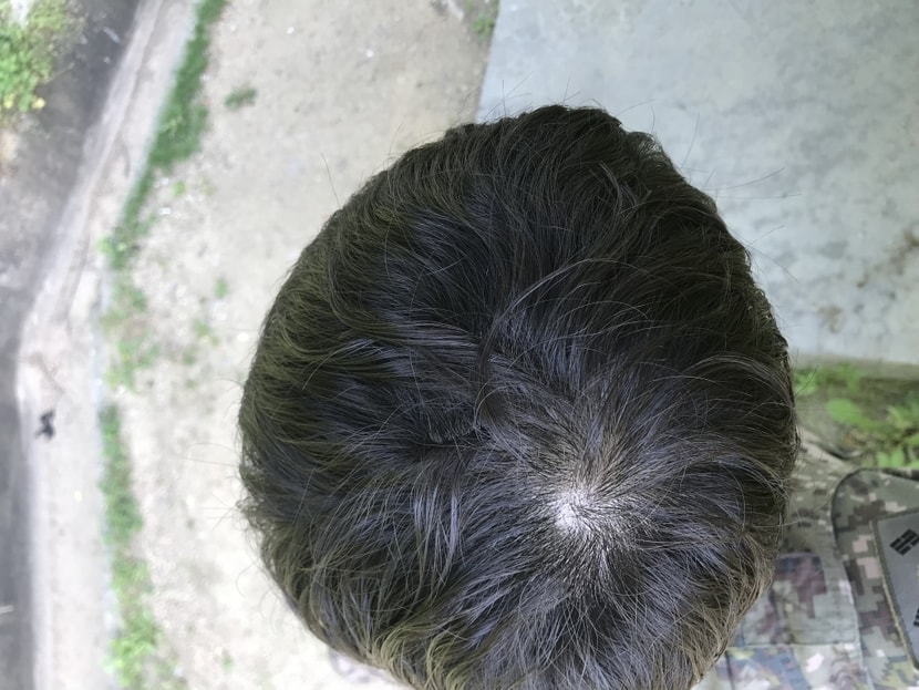 현재