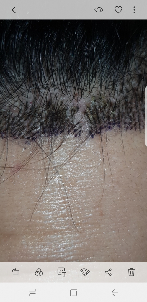 Screenshot_20190403-212802_Gallery.jpg