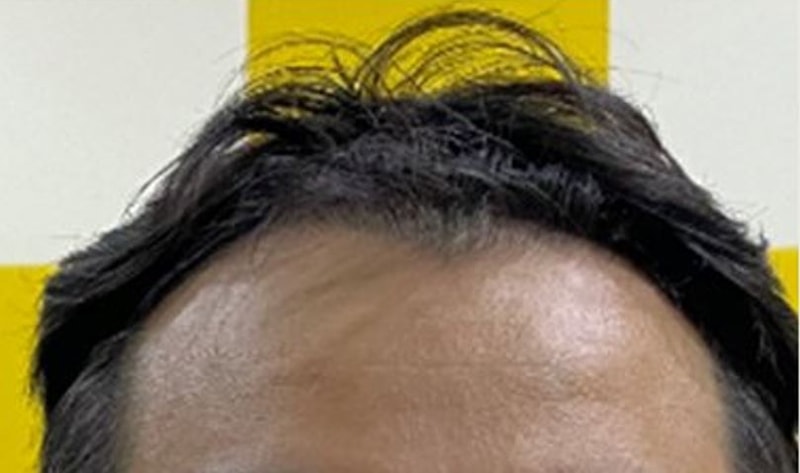 1.JPG