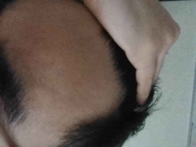 20170408_180327.jpg