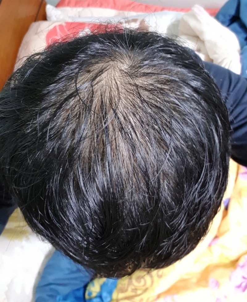 20181115_210311.jpg