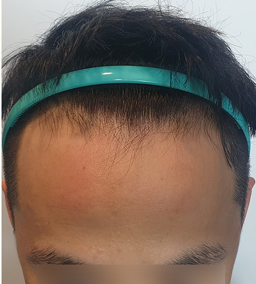 정태윤 수술 전.PNG