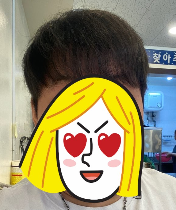 후 1.PNG