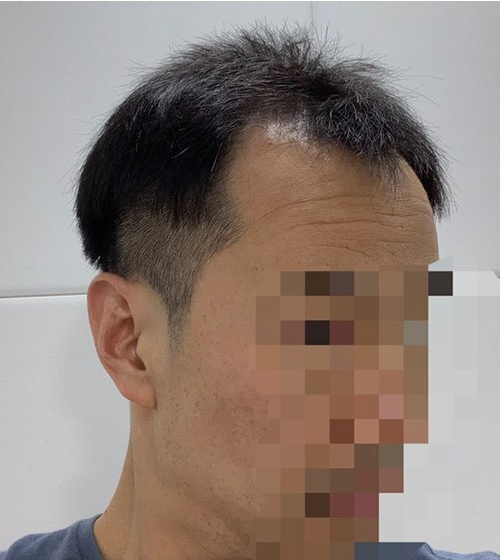최원주 수술 전.PNG