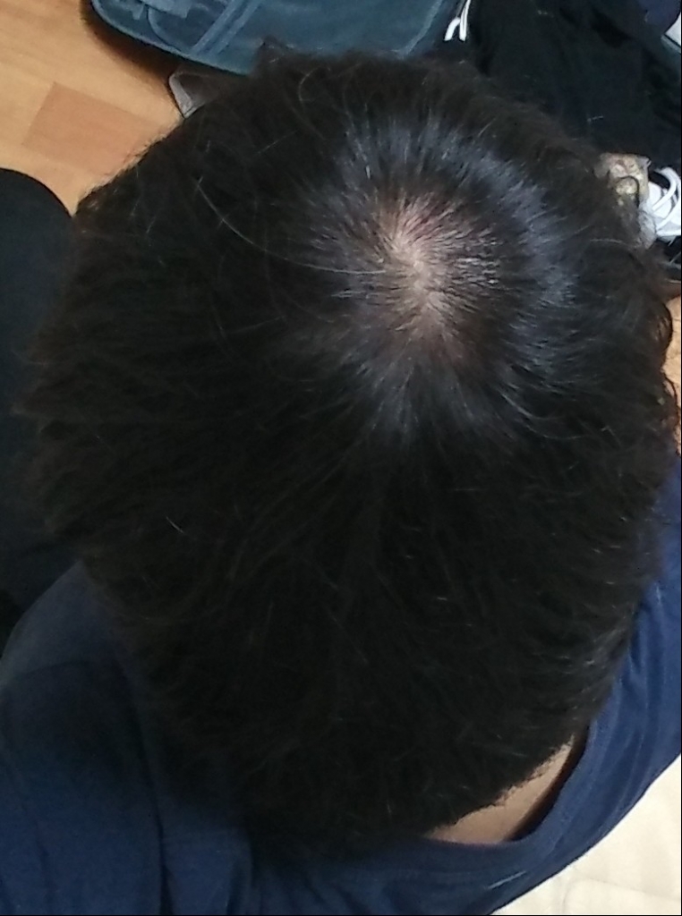 20180130_183311-1.jpg
