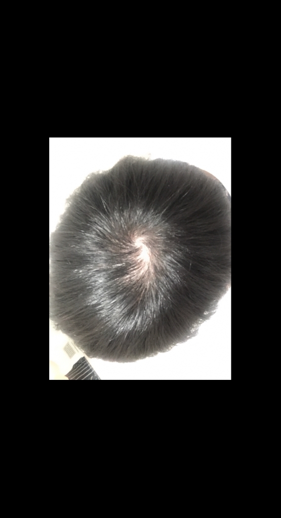 C6BB24D3-56E4-4BA9-83E9-19B6F8096F13.png