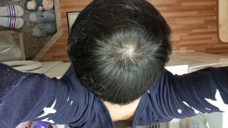 20170118_100일.jpg