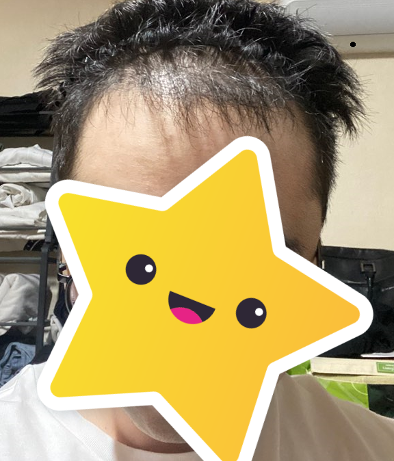 전 1.png