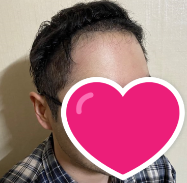 후 2.PNG