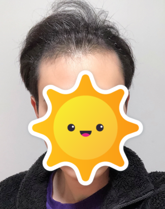 전 1.PNG