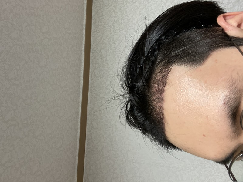 후3.jpg