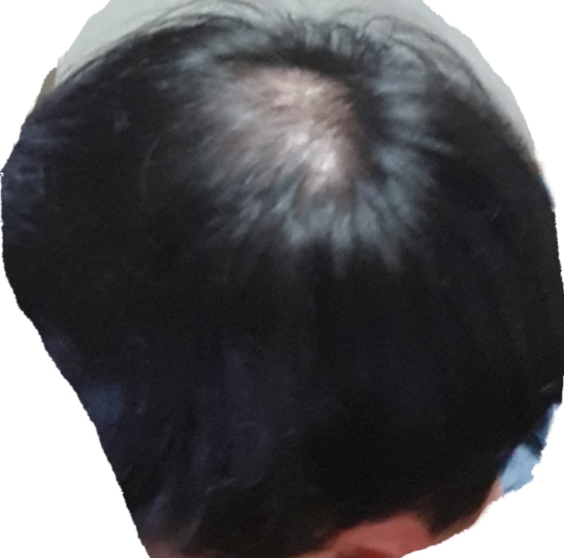 20180316_020505.png