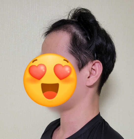 후1.PNG