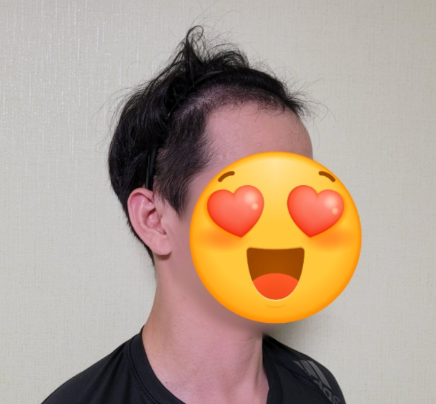 후3.PNG
