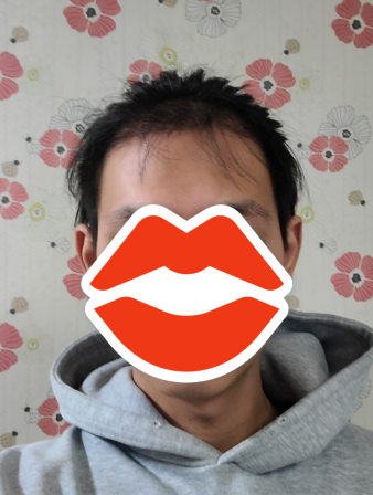 후 1.PNG