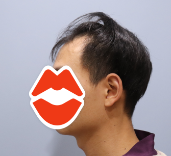전 2.PNG