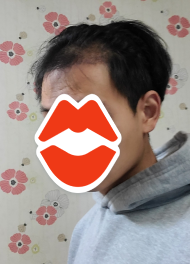 후2.PNG