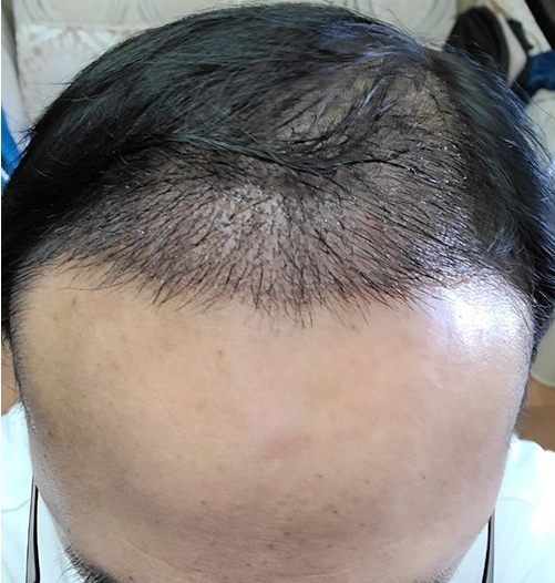 정동희 7일차 1.PNG