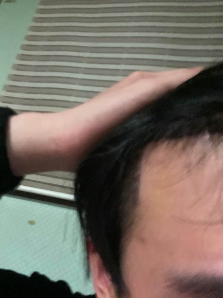 후4.jpg