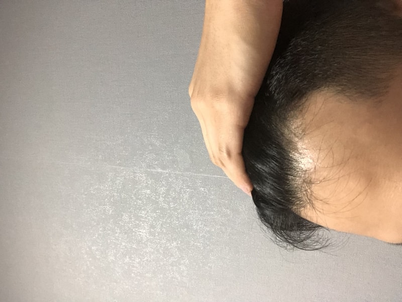 D35E08C2-2B5B-4BA5-9062-3651652897A5.jpeg